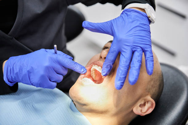 Emergency Dental Filling Replacement in OH