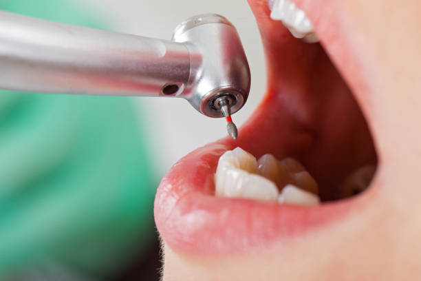 Best Tooth Pain Emergency Relief  in Groesbeck, OH